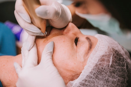 Immagine di Corso al plasma + Macchina e 50 aghi